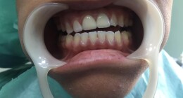 WhatsApp Image 2022-08-03 at 17.06.40 (1)